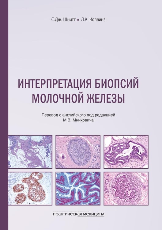 Обложка книги «Интерпретация биопсий молочной железы» — Шнитт С.Дж.;Коллинз Л.К., ISBN 9785988117704