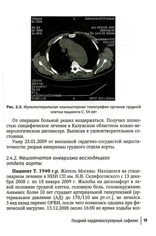 Дополнительное изображение книги «Поздние формы сифилиса с симптомами и без симптомов»