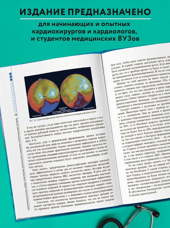 Дополнительное изображение книги «Клинические аспекты сердечно-сосудистой хирургии»