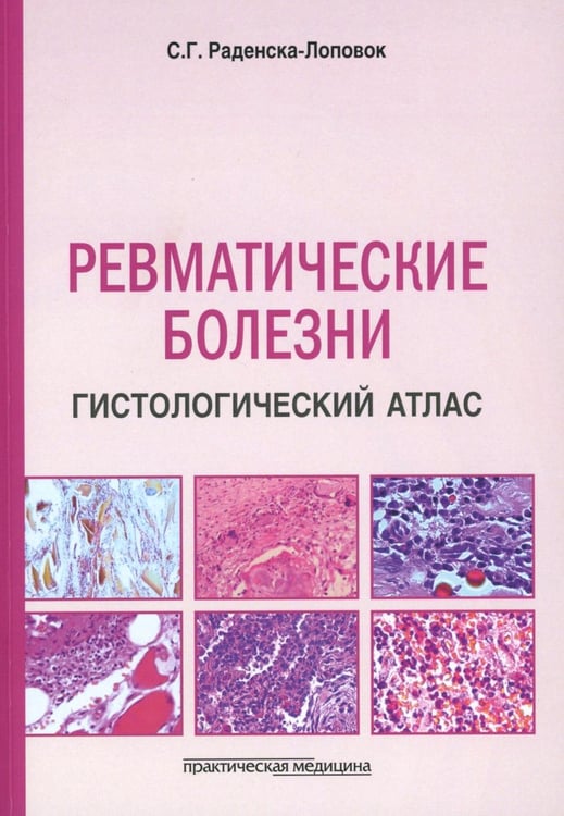 Дополнительное изображение книги «Ревматические болезни. Гистологический атлас»