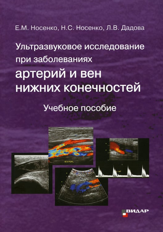 Дополнительное изображение книги «Ультразвуковое исследование при заболеваниях артерий и вен нижних конечностей. Учебное пособие»