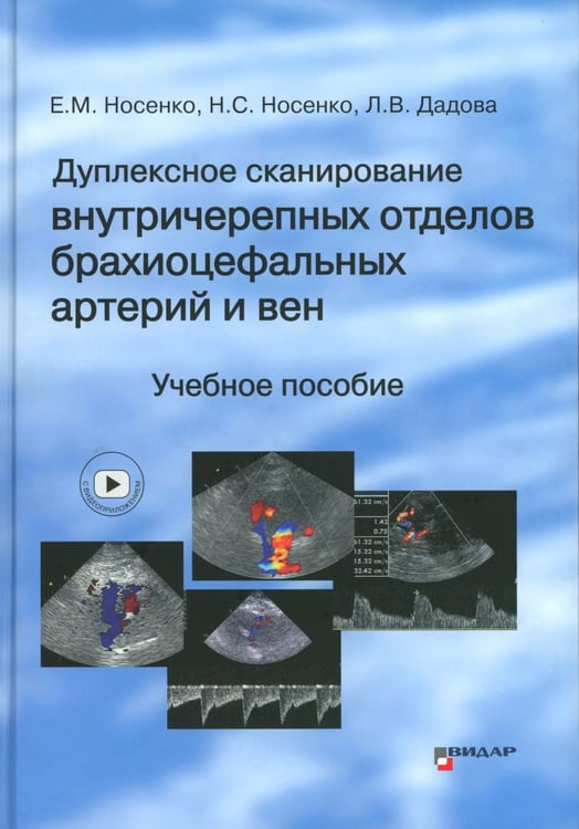 Обложка книги «Дуплексное сканирование внутричерепных отделов брахиоцефальных артерий и вен. Учебное пособие» — Носенко Екатерина Михайловна;Носенко Наталья Сергеевна;Дадова Лариса Валерьевна, ISBN 9785884292888