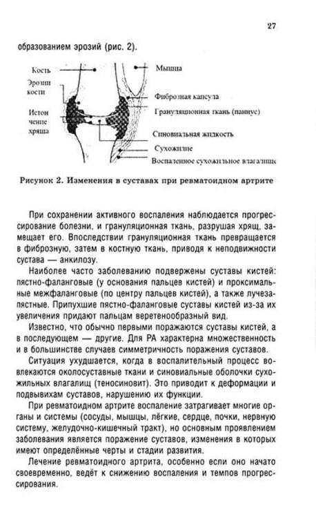 Дополнительное изображение книги «Ревматоидный артрит. Ч. 1: Современные представления о диогностике, лечении, профилактике»