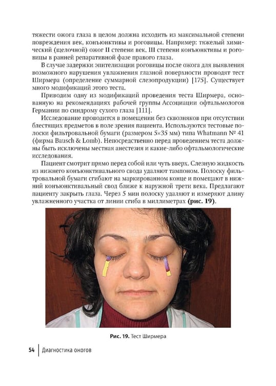 Дополнительное изображение книги «Ожоги глаз. Состояние проблемы и новые подходы. 3-е изд., перераб. и доп»