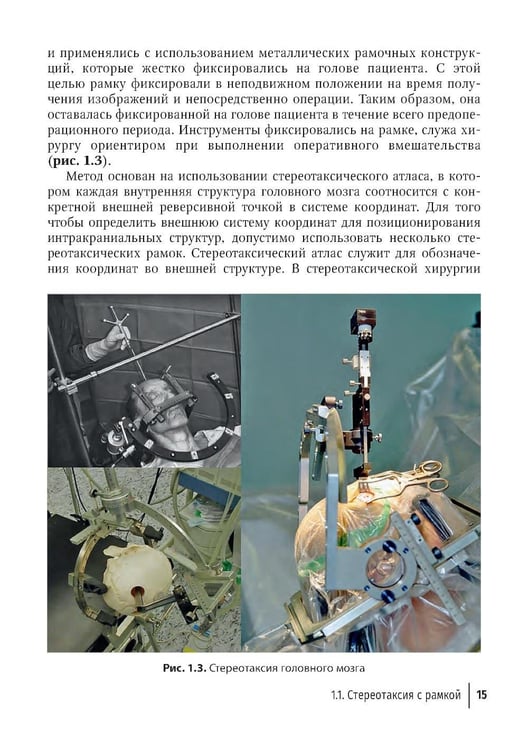 Дополнительное изображение книги «Компьютерная навигация и виртуальное планирование в ортогнатической и реконструктивной хирургии: руководство для врачей»