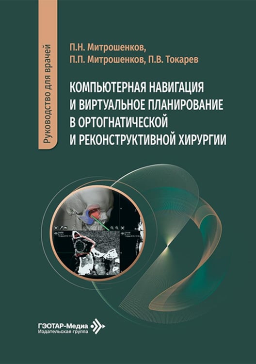 Обложка книги «Компьютерная навигация и виртуальное планирование в ортогнатической и реконструктивной хирургии: руководство для врачей» — Митрошенков Павел Николаевич;Митрошенков Петр Павлович;Токарев Павел Владимирович, ISBN 9785970490099