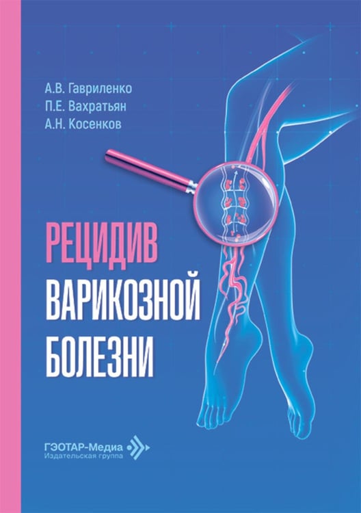 Обложка книги «Рецидив варикозной болезни» — Косенков Александр Николаевич;Гавриленко Александр Васильевич;Вахратьян Павел Евгеньевич, ISBN 9785970495995