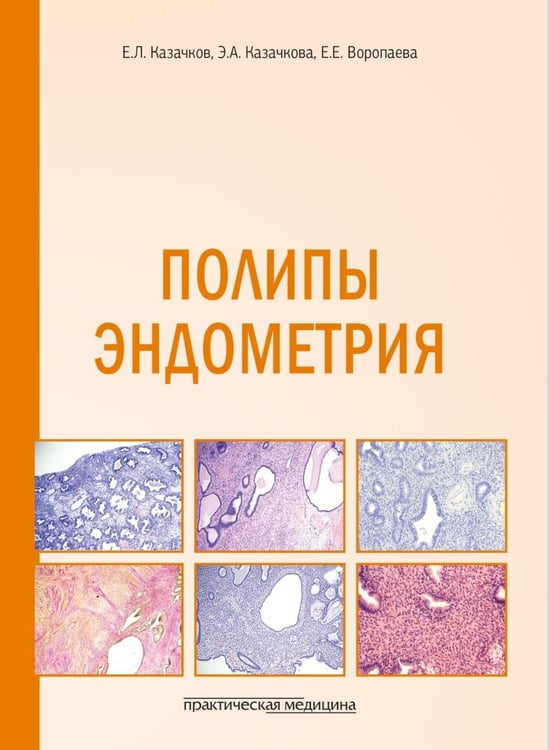 Дополнительное изображение книги «Полипы эндометрия: Учебное пособие»
