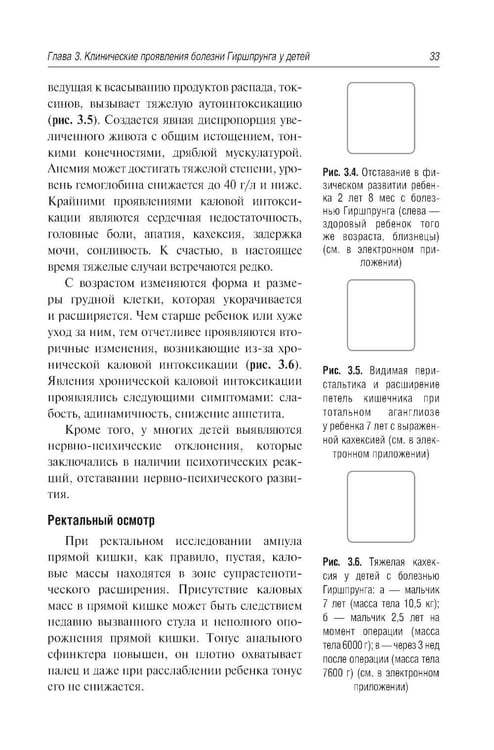Дополнительное изображение книги «Болезнь Гиршпрунга у детей. Руководство для врачей . 2-е изд., перераб. и доп»