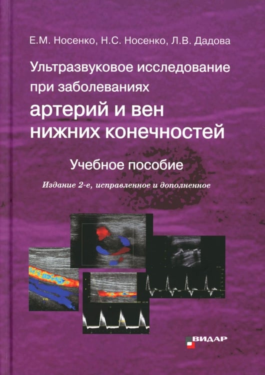 Дополнительное изображение книги «Ультразвуковое исследование при заболеваниях артерий и вен нижних конечностей: Учебное пособие. 2-е изд., испр.и доп»
