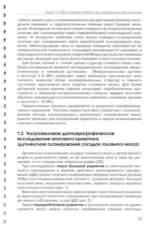 Дополнительное изображение книги «Ультразвуковая диагностика перинатального инсульта: Учебное пособие»