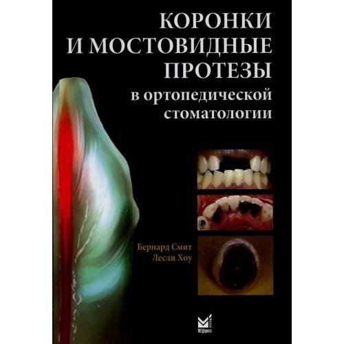 Дополнительное изображение книги «Коронки и мостовидные протезы в ортопедической стоматологии»