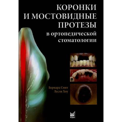 Обложка книги «Коронки и мостовидные протезы в ортопедической стоматологии» — Смит Бернард, ISBN 5983226045