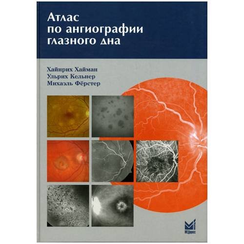 Дополнительное изображение книги «Атлас по ангиографии глазного дна»