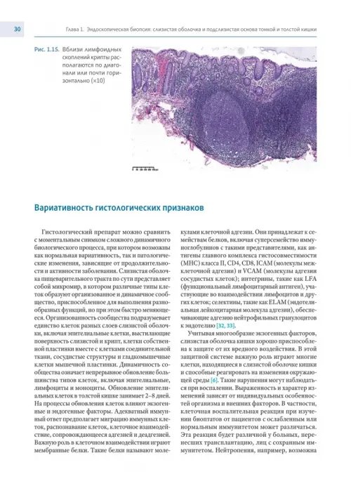 Дополнительное изображение книги «Колит. Интерпретация биопсий слизистой оболочки толстой и тонкой кишки. Диагностическое руководство»