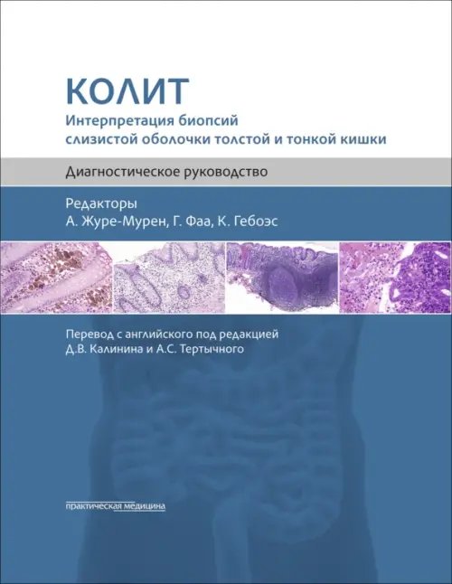 Обложка книги «Колит. Интерпретация биопсий слизистой оболочки толстой и тонкой кишки. Диагностическое руководство», ISBN 9785988118336