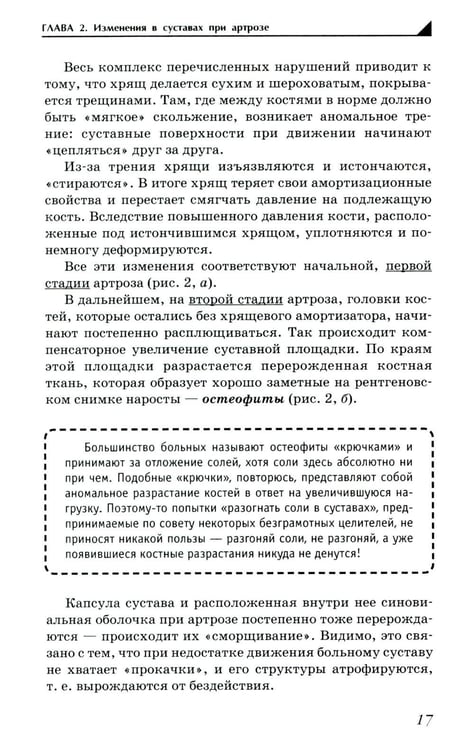 Дополнительное изображение книги «Артроз. Избавляемся от болей в суставах»