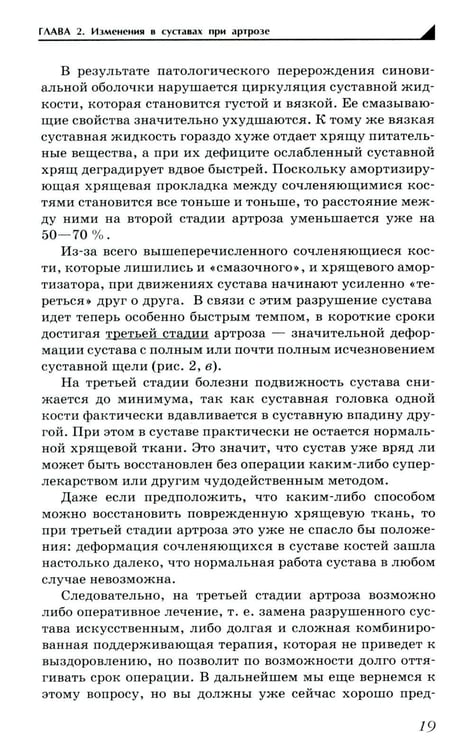 Дополнительное изображение книги «Артроз. Избавляемся от болей в суставах»