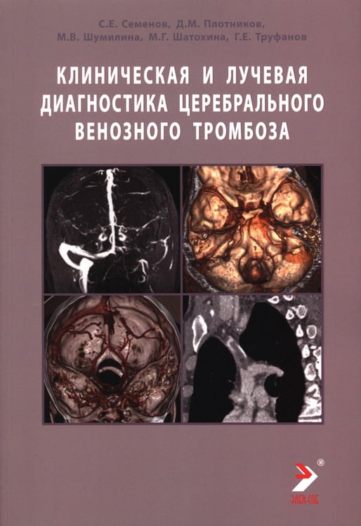 Дополнительное изображение книги «Клиническая и лучевая диагностика церебрального венозного тромбоза: Учебное пособие»