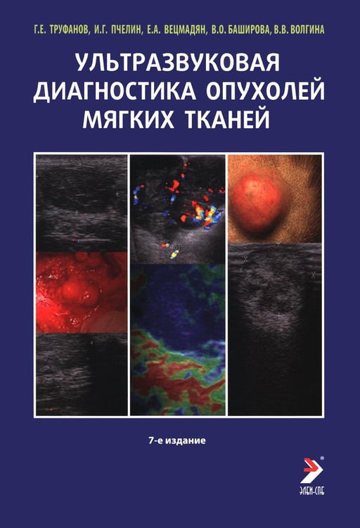 Дополнительное изображение книги «Ультразвуковая диагностика опухолей мягких тканей. 7-е изд»