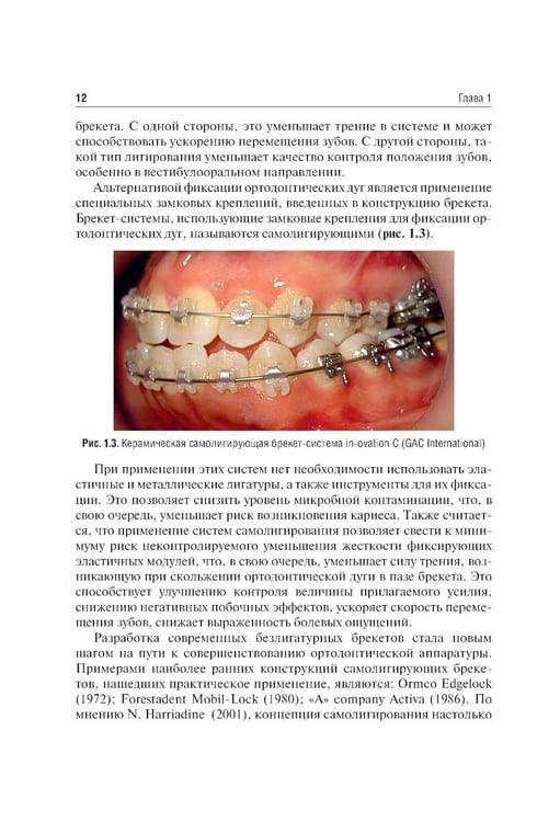 Дополнительное изображение книги «Ошибки фиксации брекет-систем и методы их устранения: Учебное пособие. 2-е изд., перераб»