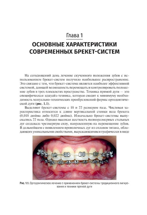 Дополнительное изображение книги «Ошибки фиксации брекет-систем и методы их устранения: Учебное пособие. 2-е изд., перераб»