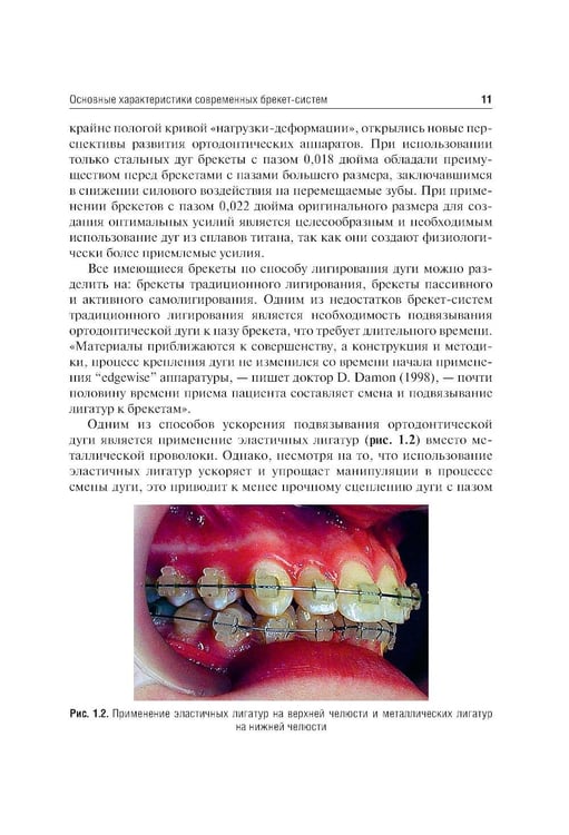 Дополнительное изображение книги «Ошибки фиксации брекет-систем и методы их устранения: Учебное пособие. 2-е изд., перераб»