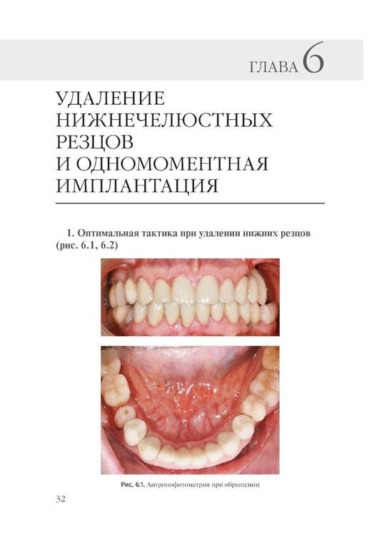 Дополнительное изображение книги «Принципы костной пластики в дентальной имплантации»