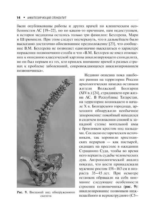 Дополнительное изображение книги «Анкилозирующий спондилит. 2-е изд., перераб. и доп»