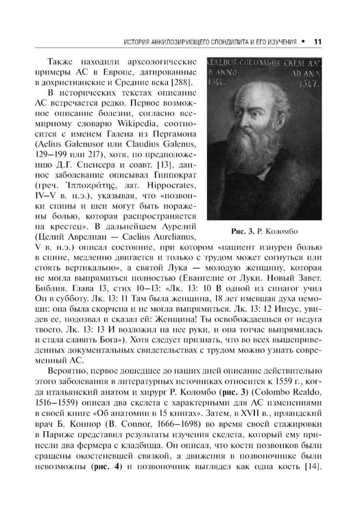 Дополнительное изображение книги «Анкилозирующий спондилит. 2-е изд., перераб. и доп»