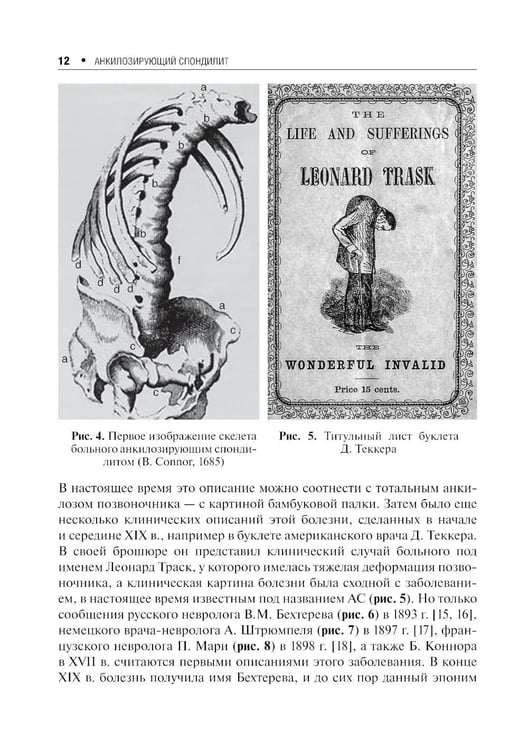 Дополнительное изображение книги «Анкилозирующий спондилит. 2-е изд., перераб. и доп»
