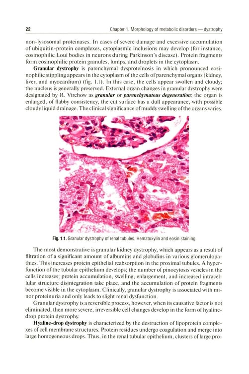 Дополнительное изображение книги «Pathological Anatomy = Патологическая анатомия: textbook. (книга на англ. яз)»