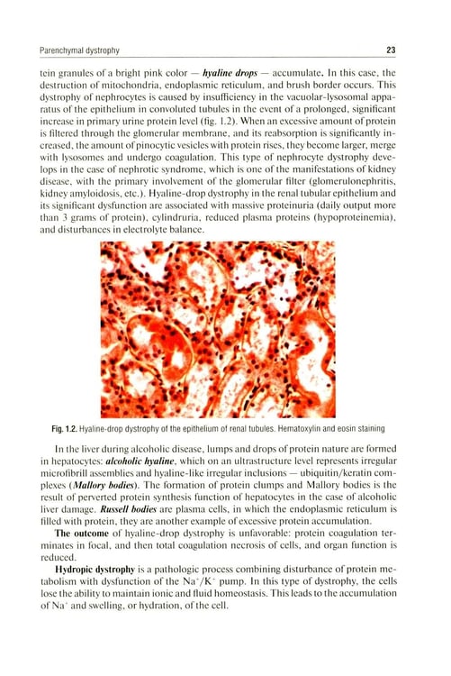 Дополнительное изображение книги «Pathological Anatomy = Патологическая анатомия: textbook. (книга на англ. яз)»