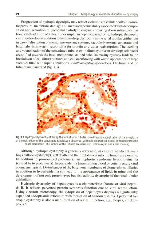 Дополнительное изображение книги «Pathological Anatomy = Патологическая анатомия: textbook. (книга на англ. яз)»
