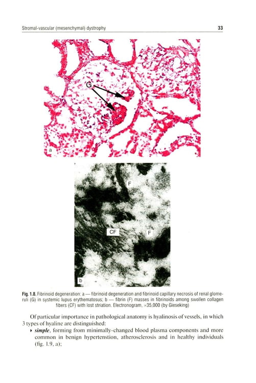Дополнительное изображение книги «Pathological Anatomy = Патологическая анатомия: textbook. (книга на англ. яз)»