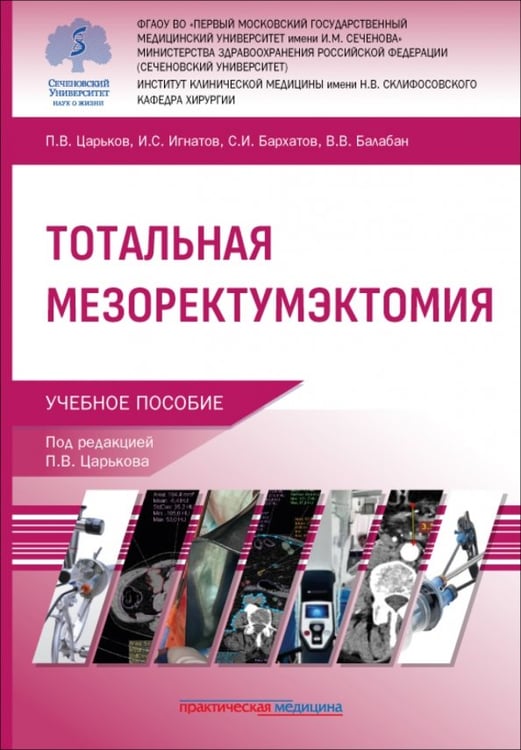 Обложка книги «Тотальная мезоректумэктомия. Учебное пособие» — Царьков Петр Владимирович, Бархатов Сергей Иванович, Балабан Владимир Владимирович, ISBN 9785988118671