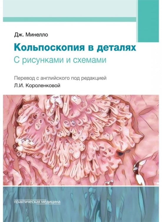 Обложка книги «Кольпоскопия в деталях. С рисунками и схемами» — Минелло Джованни, ISBN 9785988116769
