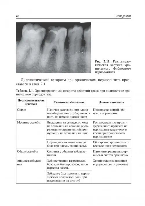 Дополнительное изображение книги «Одонтогенные воспалительные заболевания полости рта. Учебное пособие»