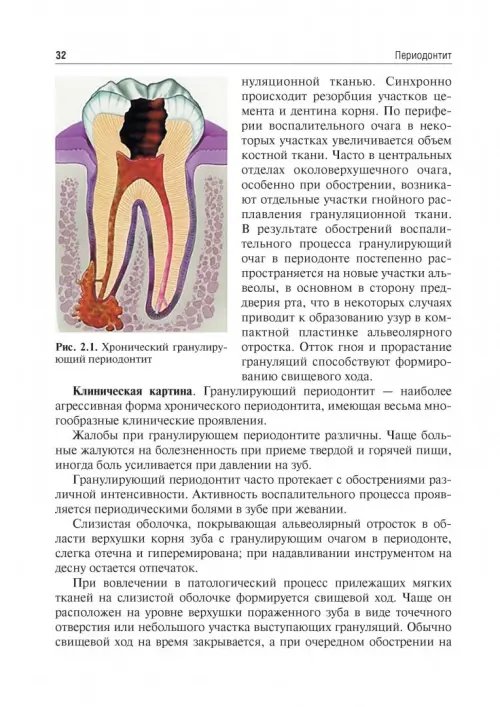 Дополнительное изображение книги «Одонтогенные воспалительные заболевания полости рта. Учебное пособие»