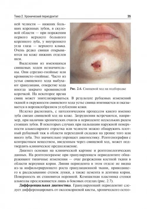 Дополнительное изображение книги «Одонтогенные воспалительные заболевания полости рта. Учебное пособие»