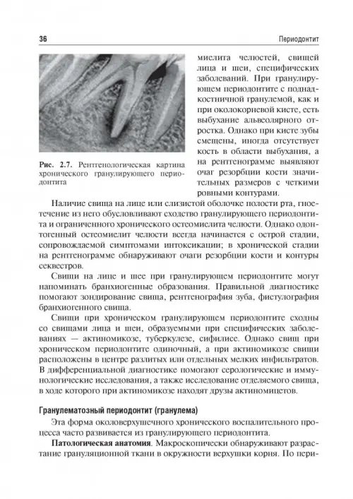 Дополнительное изображение книги «Одонтогенные воспалительные заболевания полости рта. Учебное пособие»