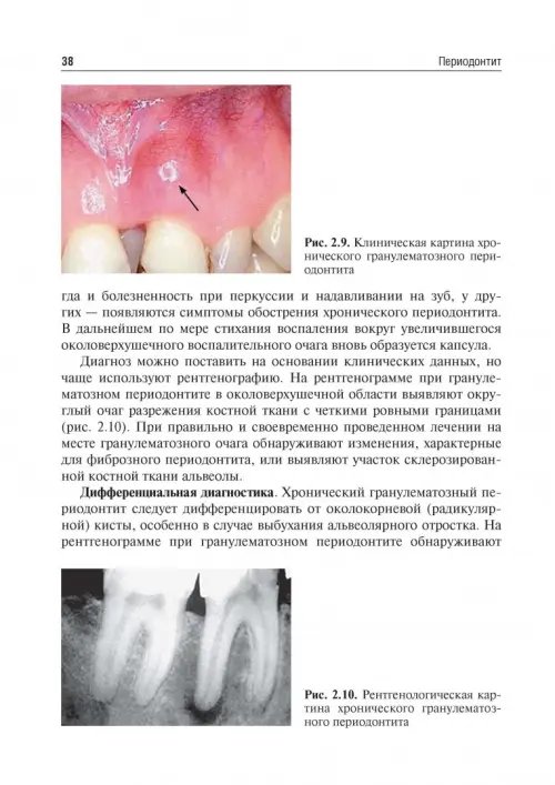 Дополнительное изображение книги «Одонтогенные воспалительные заболевания полости рта. Учебное пособие»