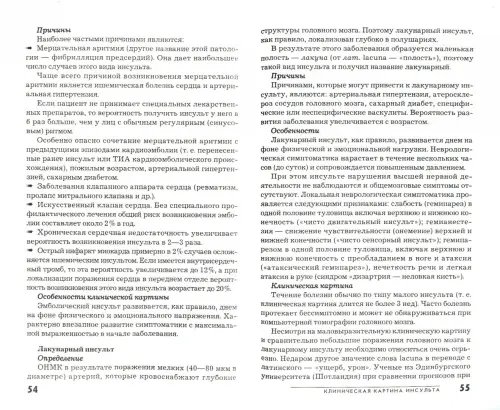 Дополнительное изображение книги «Инсульт»