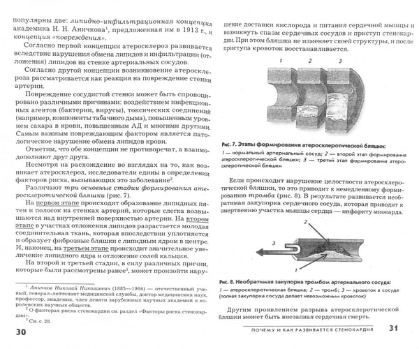 Дополнительное изображение книги «Стенокардия»