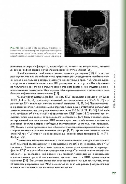 Дополнительное изображение книги «Эндоскопическая диагностика и лечение назальной ликвореи»