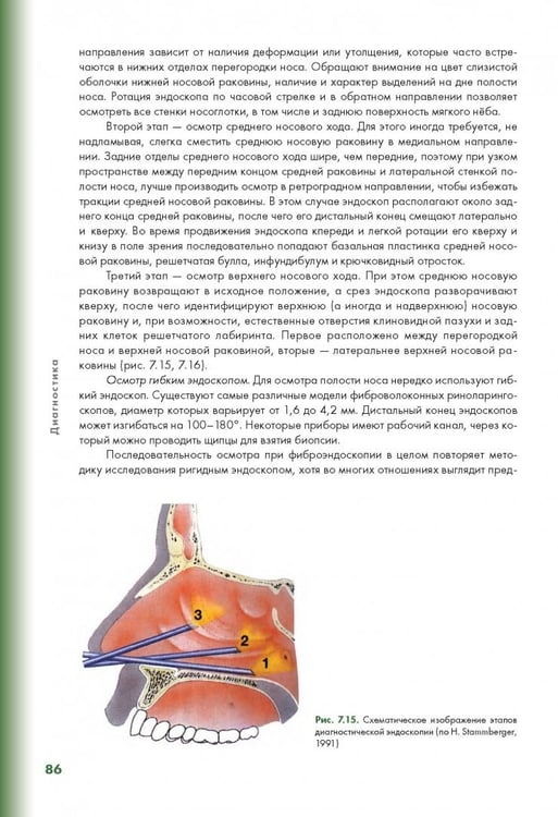 Дополнительное изображение книги «Эндоскопическая диагностика и лечение назальной ликвореи»