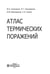 Дополнительное изображение книги «Атлас термических поражений»