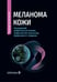 Дополнительное изображение книги «Меланома кожи: руководство для врачей»