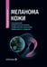 Обложка книги «Меланома кожи: руководство для врачей» — None, ISBN 9785970497548