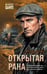 Обложка книги «Открытая рана» — Зверев Сергей Иванович, ISBN 9785042452451